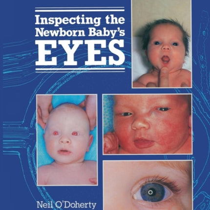 Inspecting the Newborn Baby's Eyes