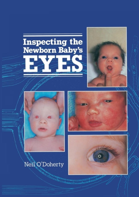 Inspecting the Newborn Baby's Eyes