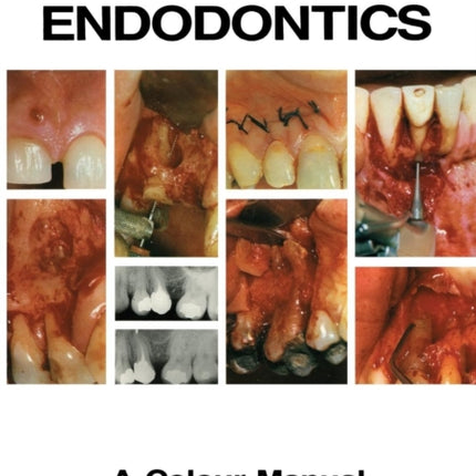 Surgical Endodontics: A Colour Manual
