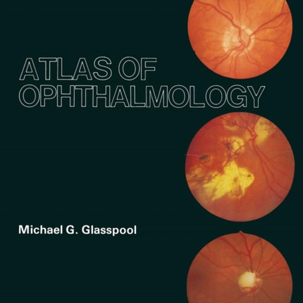 Atlas of Ophthalmology