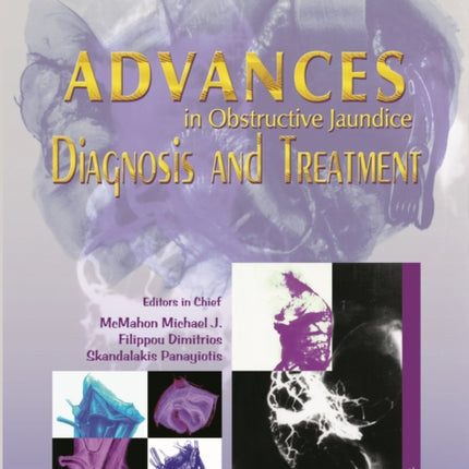 Advances in Obstructive Jaundice: Diagnosis and Treatment