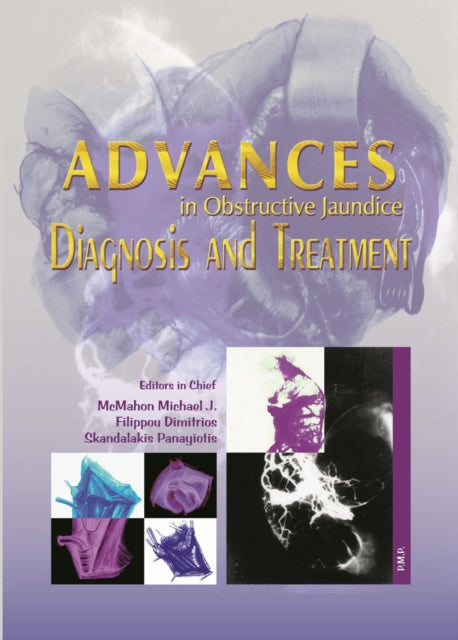 Advances in Obstructive Jaundice: Diagnosis and Treatment