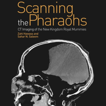 Scanning the Pharaohs: CT Imaging of the New Kingdom Royal Mummies