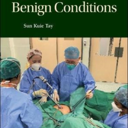 Hysterectomy For Benign Conditions