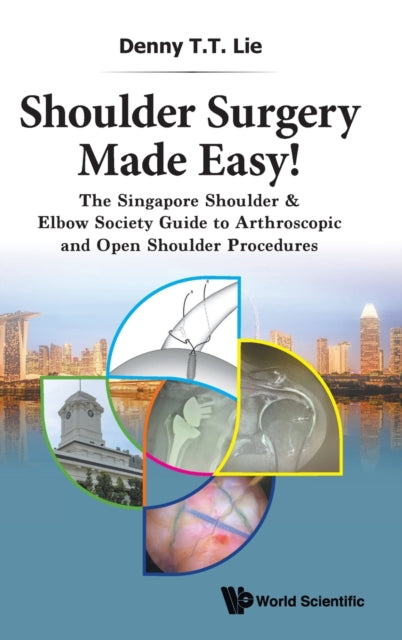 Shoulder Surgery Made Easy!: The Singapore