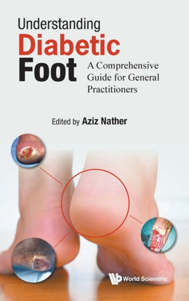 Understanding Diabetic Foot: A Comprehensive