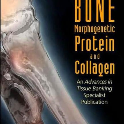 Bone Morphogenetic Protein And Collagen: An Advances In Tissue Banking Specialist Publication