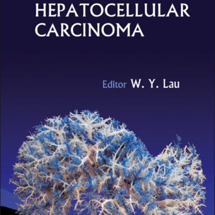 Hepatocellular Carcinoma