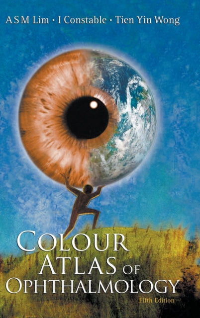 Colour Atlas Of Ophthalmology (Fifth Edition)
