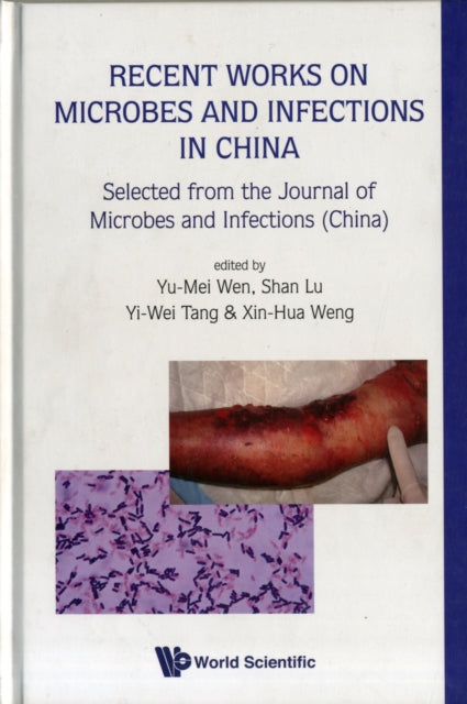 Recent Works On Microbes And Infections In China: