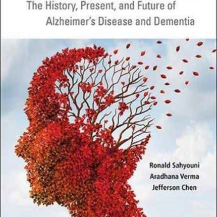 Alzheimer's Disease Decoded: The History,