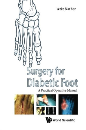 Surgery For Diabetic Foot: A Practical Operative Manual