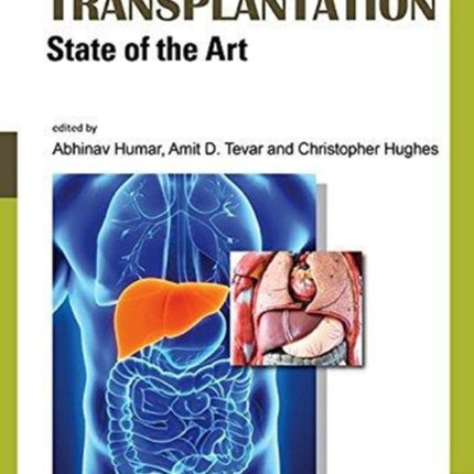 Liver Transplantation: State Of The Art