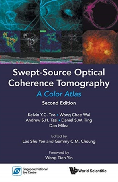 Swept-source Optical Coherence Tomography: A