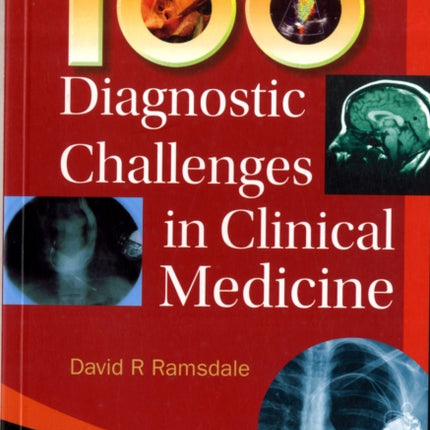 100 Diagnostic Challenges In Clinical Medicine