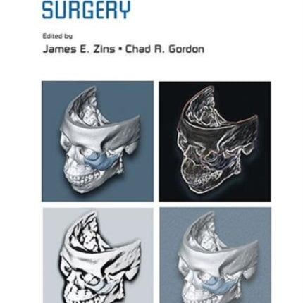 Handbook Of Craniomaxillofacial Surgery