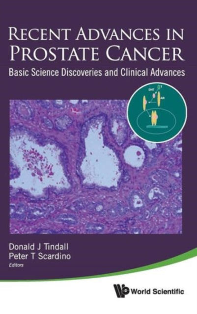 Recent Advances In Prostate Cancer: Basic Science