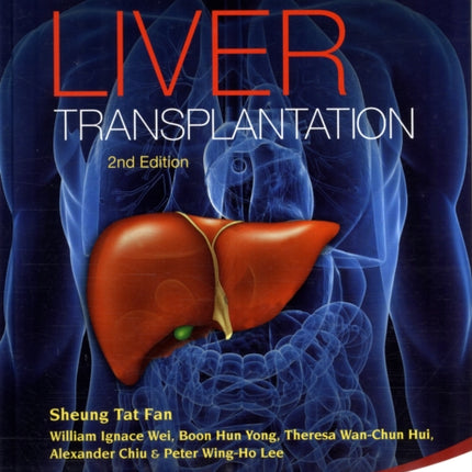 Living Donor Liver Transplantation (2nd Edition)