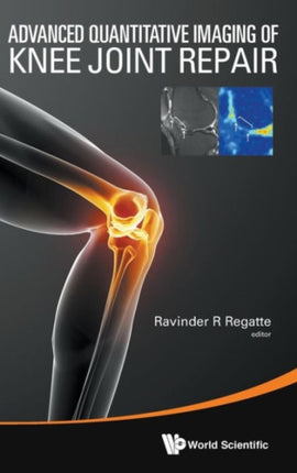 Advanced Quantitative Imaging Of Knee Joint