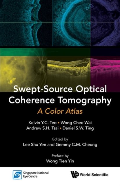 Swept-source Optical Coherence Tomography: A