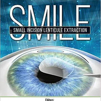 SMILE: Small Incision Lenticule Extraction