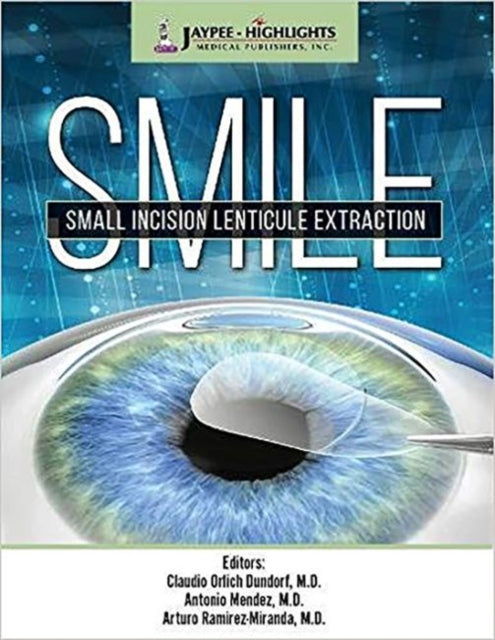 SMILE: Small Incision Lenticule Extraction