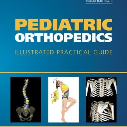 Pediatric Orthopedics