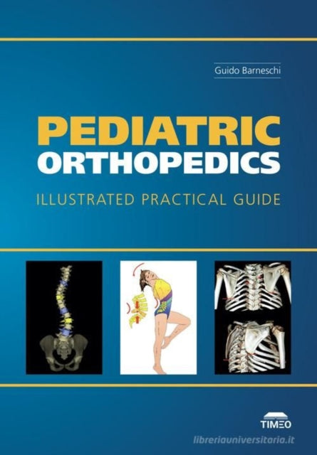 Pediatric Orthopedics