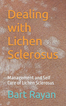 Dealing with Lichen Sclerosus: Management and Self Care of Lichen Sclerosus