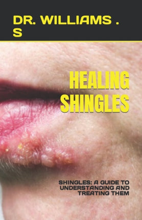 Healing Shingles: Shingles: A Guide to Understanding and Treating Them