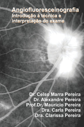 Angiofluoresceinografia: Introdução a